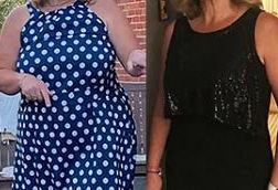 Image Get to know the price of Allurion balloon A revolutionary solution for losing weight