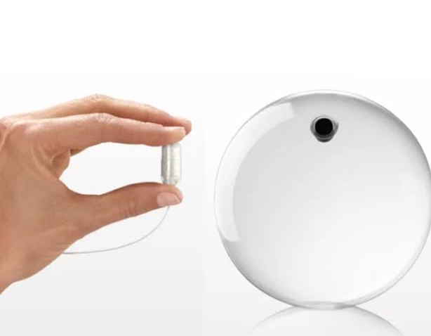 Image 12 Get to know more about Allurion Elipse Balloon for weight control