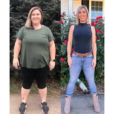 Image Weigh Loss Surgery In Perth