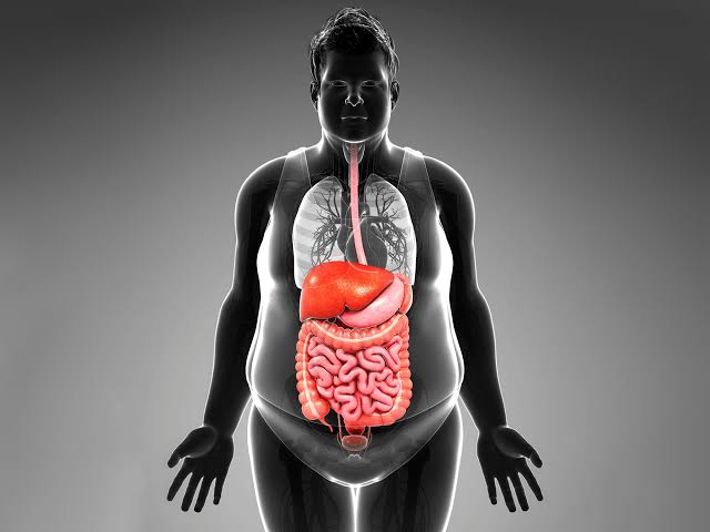 Image Benefits of Obesity Treatment in Men