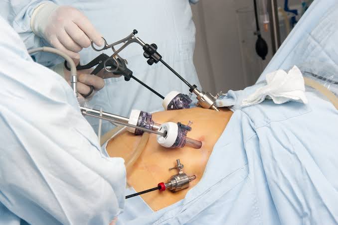 images Gallbladder Surgery