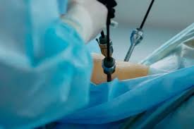 Image Prices for Routine Hernia Treatment in Perth, Australia