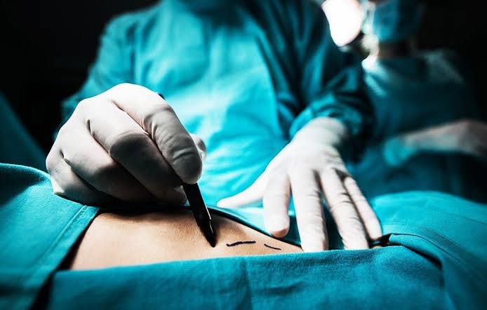 Image Weight Loss Surgery